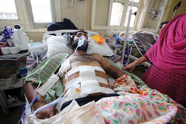 Ghulam Mohiuddin, ward 16 is hit by more than 200 pellets in his body